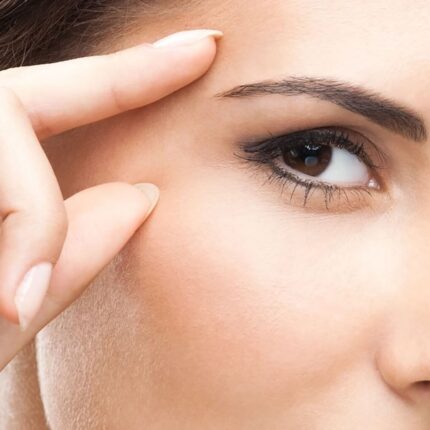 madonna lift palpebre