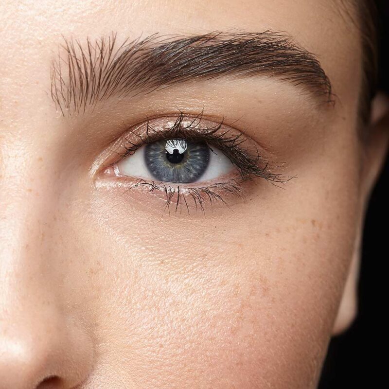 blefaroplastica palpebre